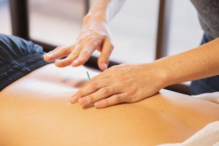 Acupuncture in India